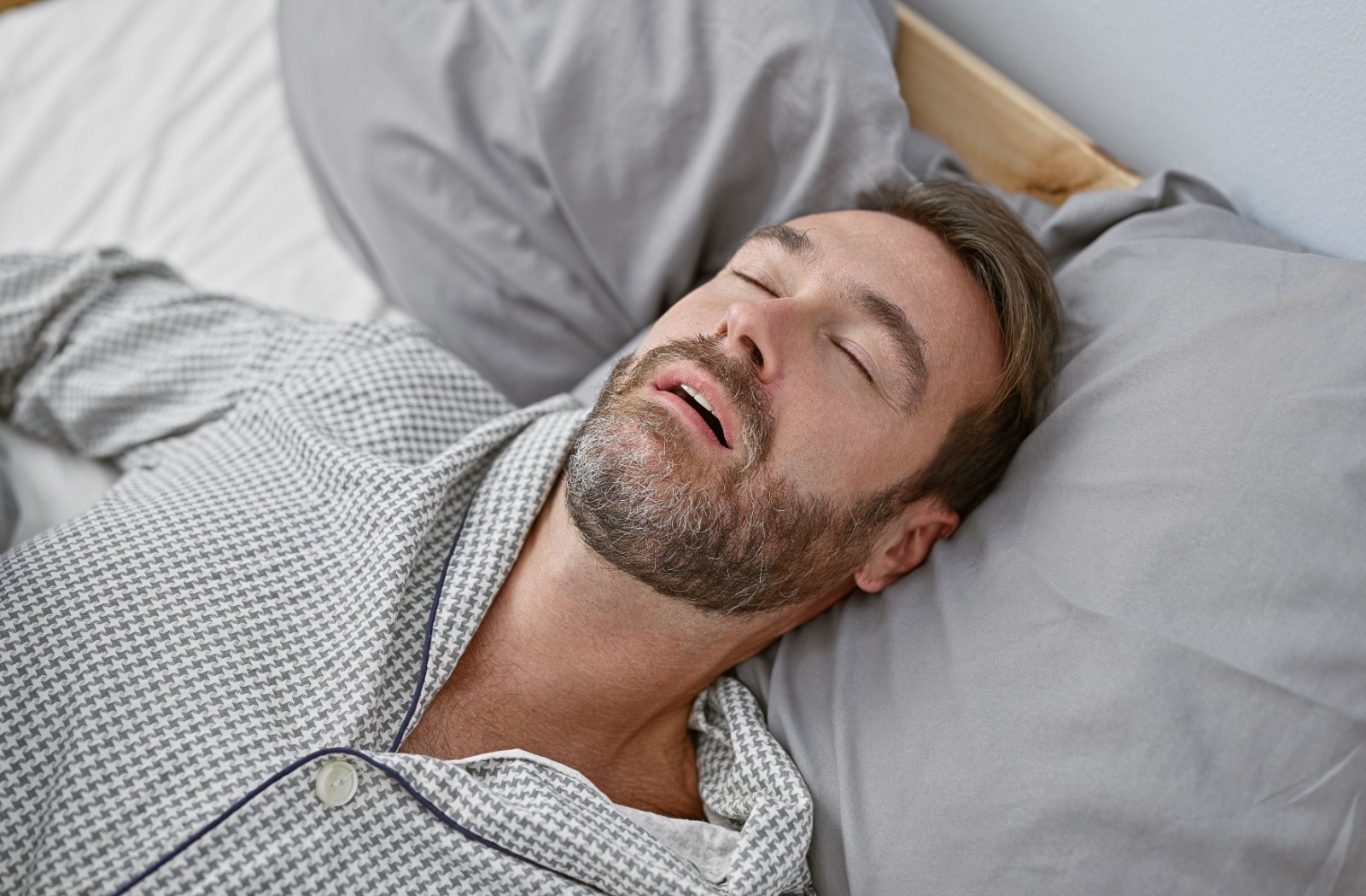 Snoring man with brown beard wearing checked pajamas lying down with eyes closed and mouth open.