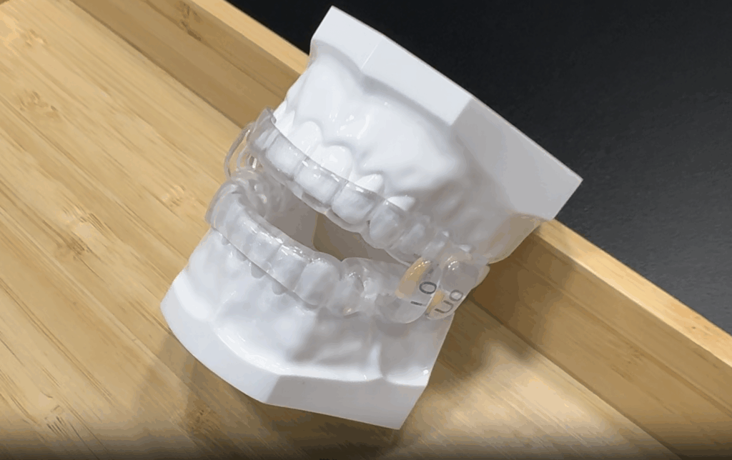 A sleep apnea oral appliance from Northwest Dental Centre in NW Calgary.